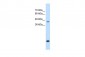 ASPN antibody - middle region